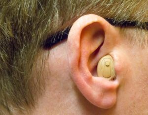 An ear canal digital hearing aid fitted to a patient.